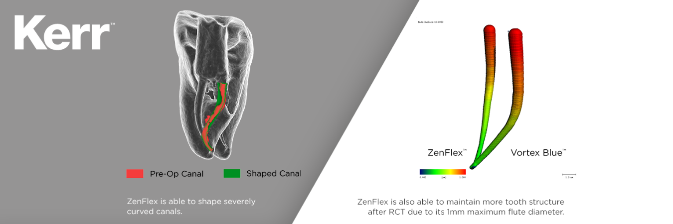 Kerr Zenflex