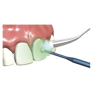 MicroStix original hold blauw - STIX64B