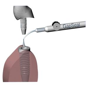 GapSeal - Set - Bevat 10 Tips � 0,06 ml en 1 applikator