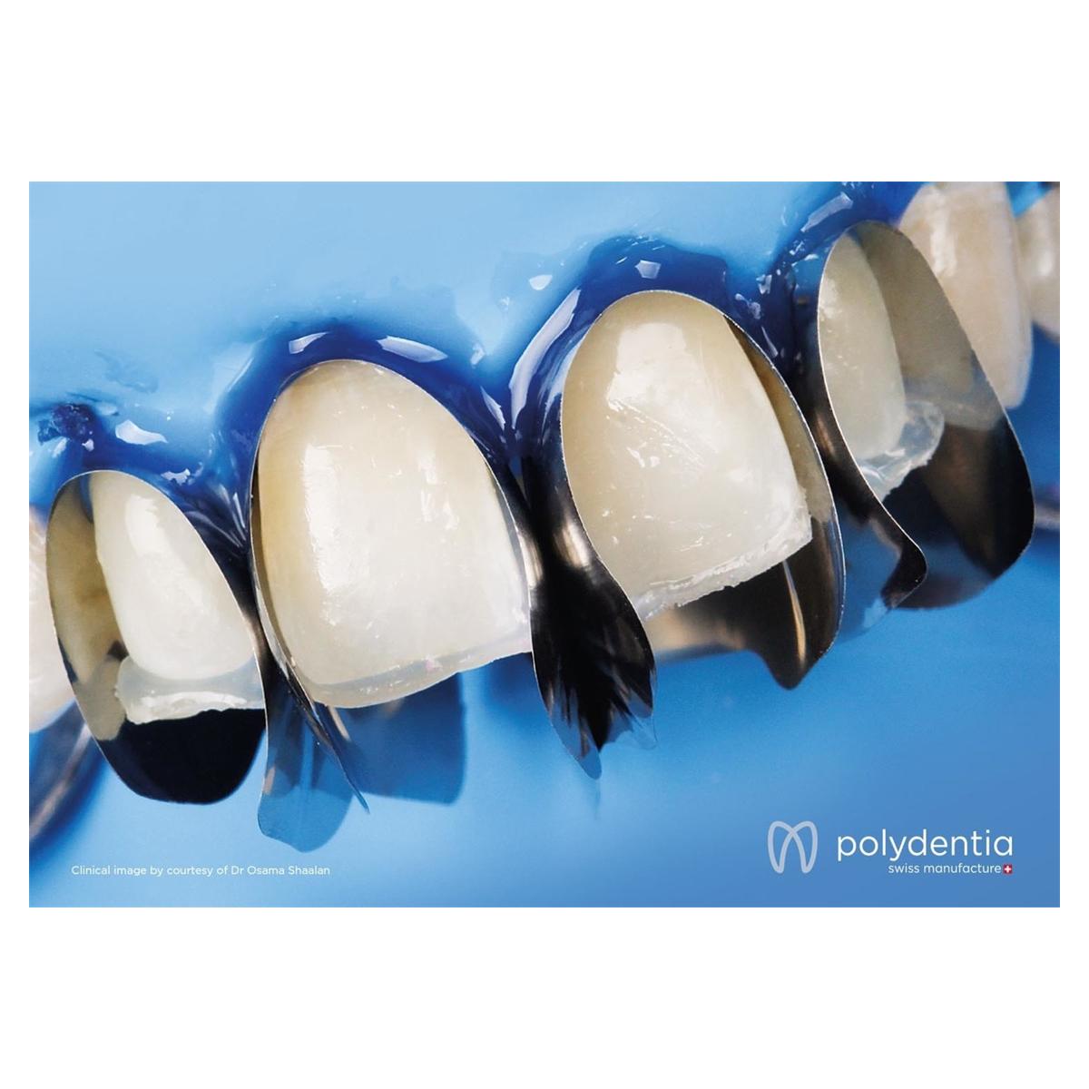 Unica minideep anterior matrix - 12 stuks