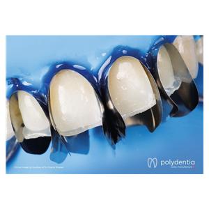 Unica minideep anterior matrix - 12 stuks