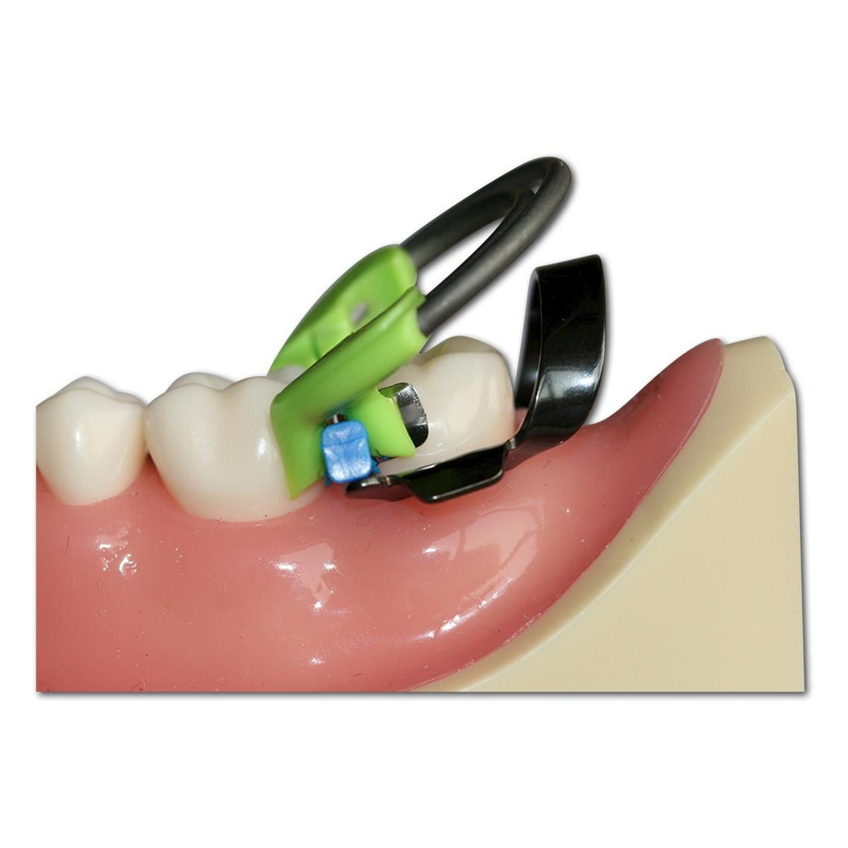 Dual Force Matrix ring - Molaar (groen) - 2 stuks